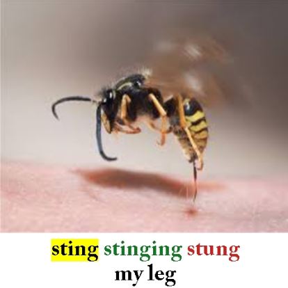 Sting2